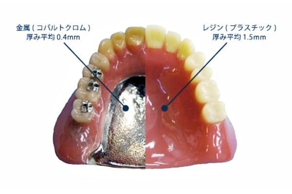 金属床入れ歯