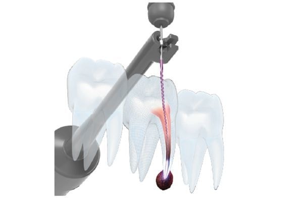 あいファミリー歯科|診療詳細|歯周病|